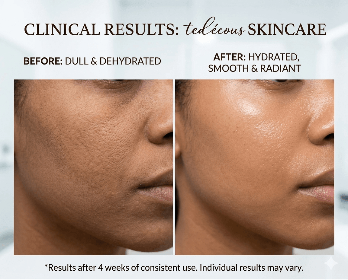 Before and after clinical results of using Tea-licious Skincare Natural African Oil Serum showing improved hydration and a smoother complexion